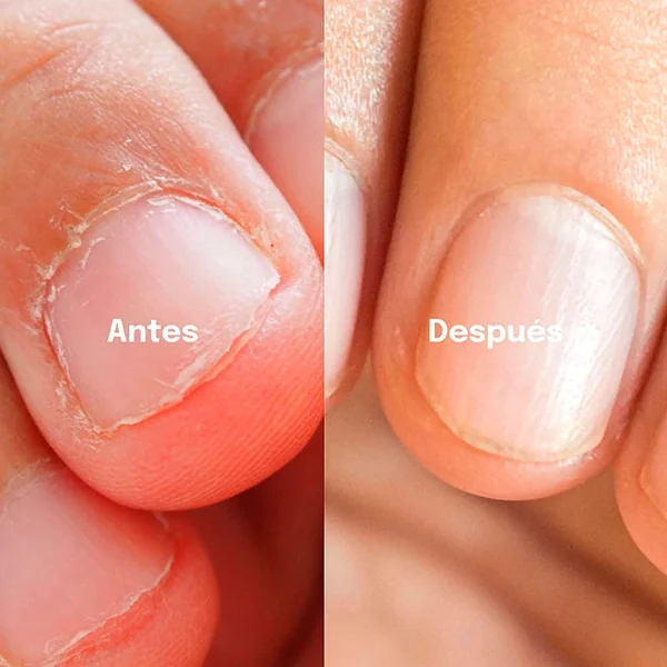 Esmalte Anti Mordeduras para las Uñas con Sabor Amargo