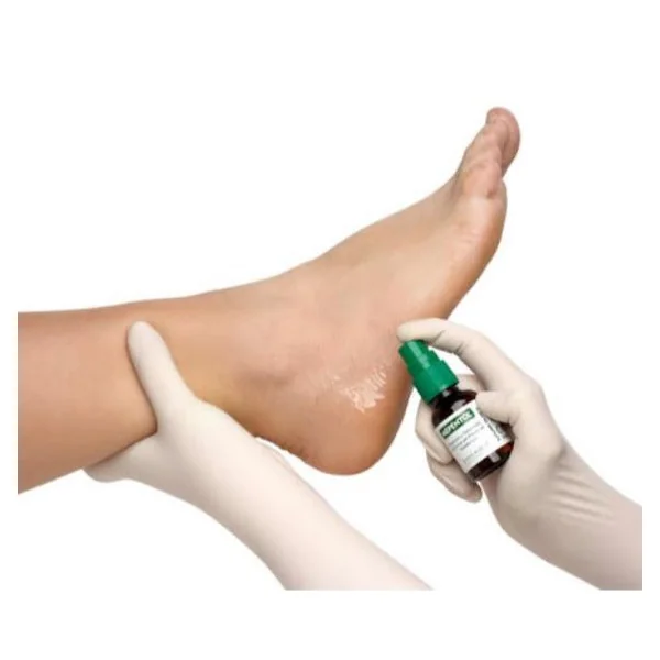 Mepentol Solución Tópica | Prevención y Tratamiento de Úlceras